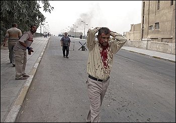 An injured man walks away after a massive bomb attack in Baghdad, Iraq, Sunday, Oct. 25, 2009. Iraq police say that a pair of powerful explosions went off near the Ministry of Justice and the offices of a Kurdish political party during the morning rush hour as people headed to work. (AP Photo/Karim kadim)
